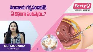 How embryos are transferred into the uterus in Telugu  #embryotransfer