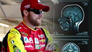 Dale Earnhardt Jr. to Donate Brain to Concussion Research