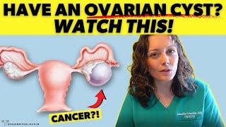 What to know if you have an OVARIAN CYST    Dr. Jennifer Lincoln