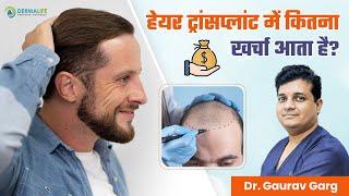हेयर ट्रांसप्लांट में कितना खर्चा आता है?  Cost of Hair Transplant in Delhi by Dr. Gaurav Garg