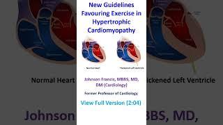 New Guidelines Favouring Exercise in Hypertrophic Cardiomyopathy