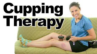 Using Cupping Therapy to Relieve Pain