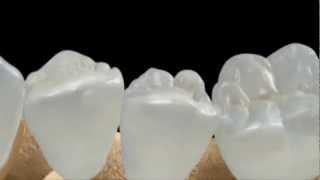 Регенерация зубов  Tooth Regeneration