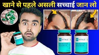 DHT Blocker With Biotin की असली सच्चाई  Hk Vitals Dht Blocker With Biotin Review