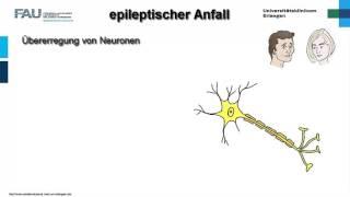 Neuropathologie ─ Epilepsie
