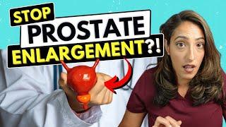 Best Ways to Prevent Prostate Enlargement Explained by a Urologist