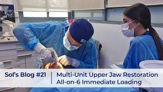 Multi-Unit Upper Jaw Restoration All-on-6 Immediate Loading Full Live Surgery - with Annotations v3