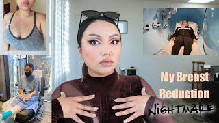 My Breast Reduction Surgery Nightmare +Storytime  