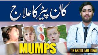 Mumps Treatment  Kan Paray Ka Ilaj in Urdu  Mumps Swelling Causes Symptoms & Treatment in Urdu