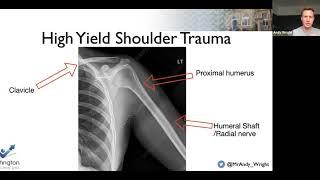 Shoulder FRCS orth revision Wrightington w BOTA