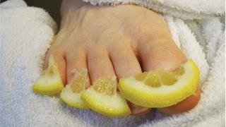 This Will DESTROY Toenail Fungus For Good