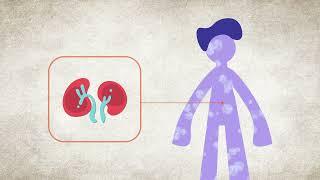 High Potassium Hyperkalemia - Symptoms & Causes  National Kidney Foundation
