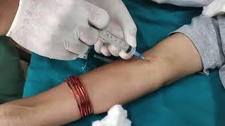HOW to withdraw arterial blood