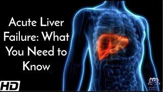 Acute Liver Failure What You Need To Know