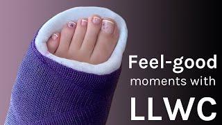 Feel-good Momente mit LLWC Gipsbein long leg cast toe plate