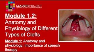 Module 1.2- Cleft Palate Speech and Feeding Anatomy and Physiology of Cleft Lip and Palate