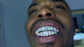 VVS Diamond Grillz In 14KT Yellow Gold & White Gold