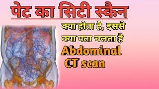 पेट का सिटी स्कैन क्यों और कैसे किया जाता है?  Abdominal CT scan in Hindi  MedHealth Support