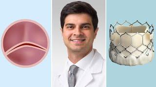 Bicuspid Aortic Valves Surgical & Transcatheter Aortic Valve Replacement Options for Patients