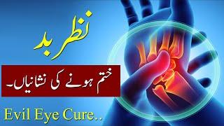 Nazar e Bad Khatam Hone ki Nishaniyan Evil Eye Cure