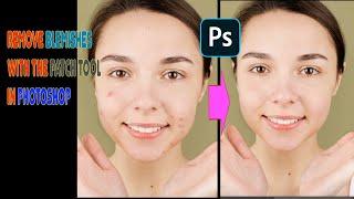 Get Flawless Skin How to Remove Blemishes with the Patch Tool in Photoshop