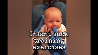 Infant Suck Training Exercises