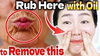 Rub Here with Oil the Nasolabial Folds and Mouth Wrinkles will Disappear