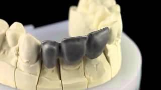 Металл Ceramill Sintron - революция в  CADCAM