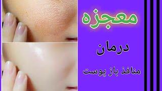درمان منافذ باز پوست در خانه - رموز طلایی برای بستن منافذ باز پوست