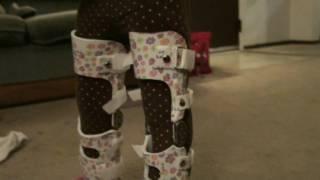 Putting On My Daughters New Leg Braces and walking update