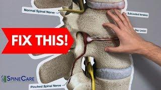 How to Fix a Bulging Disc in Your Lower Back  RELIEF IN SECONDS