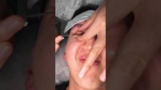 Trying China’s Craziest Eyeball Massage 