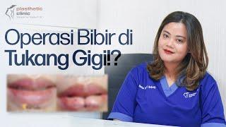 Operasi Bibir di Tukang Gigi? Ini Reaksi Dokter Bedah‼️ 