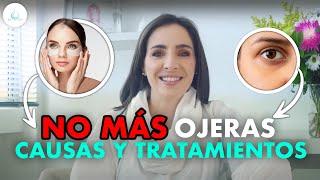  34. Que tipos de OJERAS existen y como se ELIMINAN? Aprende a diagnosticar y tratar tu ojera