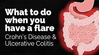 What to do if you have a Crohns disease or ulcerative colitis flare  GI Society