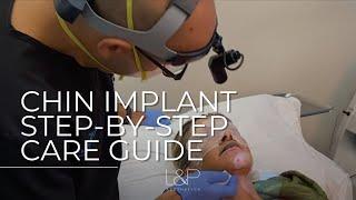 Post Chin Implant Care - Step-By-Step Instructions From L&P Aesthetics In Palo Alto CA