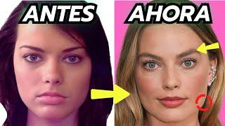 20 Celebridades Con Cirugías Plásticas Y No Sabías - Increíble