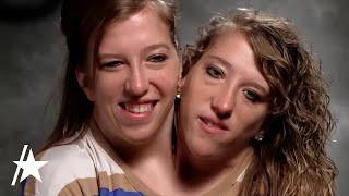 Conjoined Twin Abby Hensel Of Abby & Brittany Is MARRIED