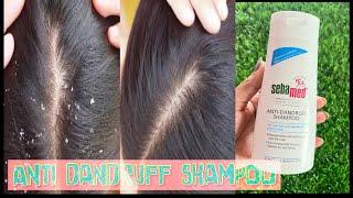 Seba med hair care anti dandruff ￼shampoo review  radness yellowish dandruff￼ problam solution