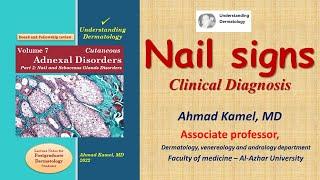 Nail signs Clinical Diagnosis of Skin Diseases