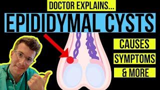 Doctor explains TESTICULAR LUMPS PART 1 - EPIDIDYMAL CYSTS causes symptoms and treatments