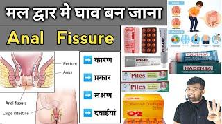 Anal Fissure  गुदा में घाव होना  Medicine  Treatment  Doctor  Pharmacy  Medicine knowledge