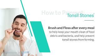 Fresh Dental Family Emergency Dentistry & Implant  Storytelling How to Prevent Tonsil Stones