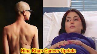 Hina Khan Goes Bald Due to Breast Cancer Stage 3 Treatment Chemotherapys Side Effects