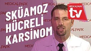 Skuamöz Hücreli Karsinom   Medical Park   TV