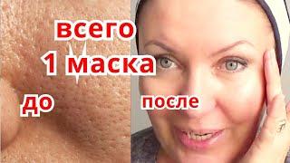 СИЛЬНЕЙШАЯ Маска для Сужения Пор Уход за Кожей с Расширенными Порами от Морщин Рецепт