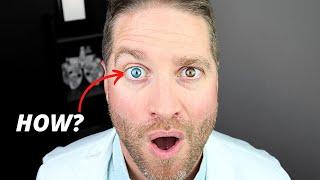 Heterochromia Different-Colored Eyes - How Does This Happen?