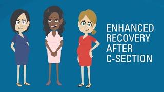 Improving C-Section Recovery The ERAS Program Helps You Heal