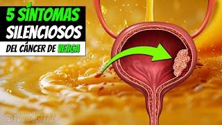 🩸 5 Síntomas SILENCIOSOS Del Cáncer De Vejiga - CUIDADO