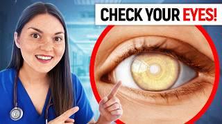 What Your EYES Say About your HEALTH Doctor Explains
